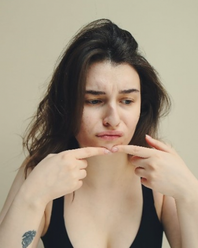 여드름약 먹을 때 영양제 먹으면 안 된다던데…